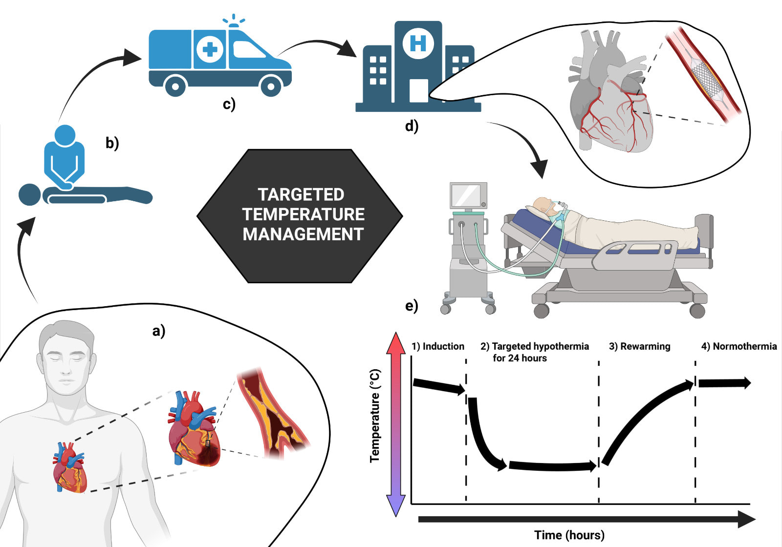 Temperature Management And Its Role In Cardiac Arrest Patients—a Review Mre Press
